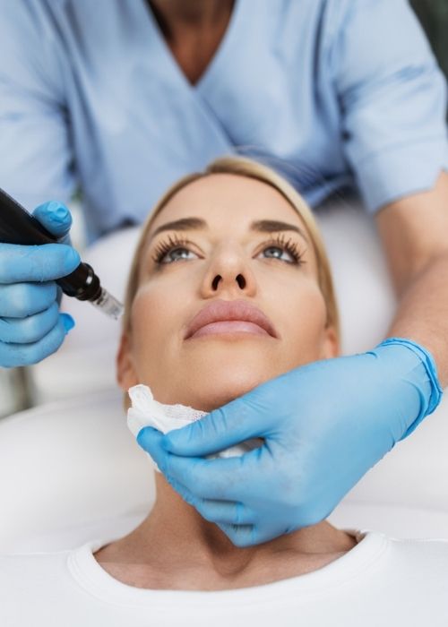 microneedling treatment process